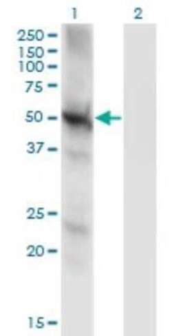PPP3CC Antibody (4D1), Novus Biologicals 0.1 mg | Buy Online | Novus Biologicals | Fisher Scientific