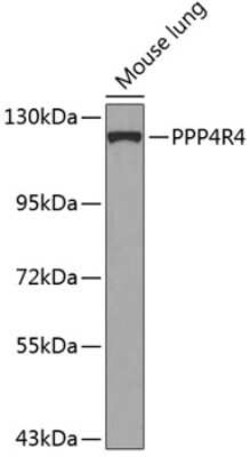 PPP4R4 Antibody - BSA Free, Novus Biologicals 0.1 mL; Unconjugated:Antibodies,
