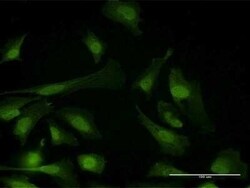 PPP6C Antibody, Novus Biologicals 0.05 mg | Buy Online | Novus Biologicals | Fisher Scientific