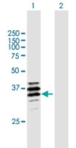 PPT2 Antibody, Novus Biologicals 0.05 mg | Buy Online | Novus Biologicals | Fisher Scientific