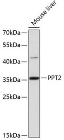 PPT2 Antibody - Azide and BSA Free, Novus Biologicals 0.02 mL; Unconjugated:Antibodies,