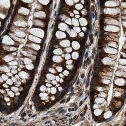 PPWD1 Antibody, Novus Biologicals 0.1 mL | Buy Online | Novus Biologicals | Fisher Scientific