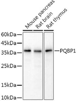 PQBP1 Rabbit anti-Mouse, Rat, Clone: 8D8H6, Novus Biologicals 20 &mu;g;