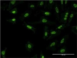 PQBP1 Antibody (3H7), Novus Biologicals 0.1 mg | Buy Online | Novus Biologicals | Fisher Scientific