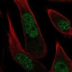 PR48 Rabbit anti-Human, Polyclonal, Novus Biologicals:Antibodies:Primary