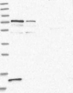PR48 Rabbit anti-Human, Polyclonal, Novus Biologicals:Antibodies:Primary