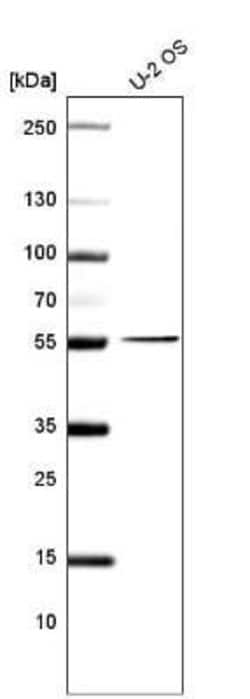 PRAME Antibody (CL5146), Novus Biologicals 100&mu;L:Antibodies, Monoclonal