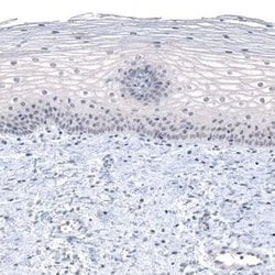 PRAME Antibody (CL5148), Novus Biologicals:Antibodies:Primary Antibodies