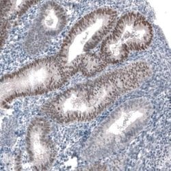 PRAME Antibody (CL5148), Novus Biologicals:Antibodies:Primary Antibodies