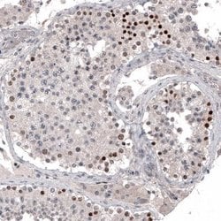 PRAME Antibody (CL5148), Novus Biologicals:Antibodies:Primary Antibodies