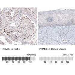 PRAME Antibody (CL5148), Novus Biologicals:Antibodies:Primary Antibodies