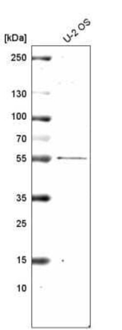PRAME Antibody (CL5148), Novus Biologicals:Antibodies:Primary Antibodies