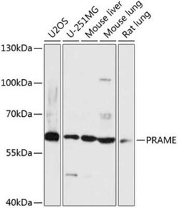 PRAME Antibody - Azide and BSA Free, Novus Biologicals 0.02 mL; Unconjugated:Antibodies,