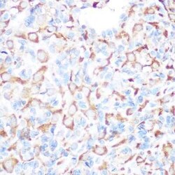 PRAMEF20 Antibody - BSA Free, Novus Biologicals:Antibodies:Primary Antibodies