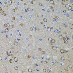 PRAMEF20 Antibody - BSA Free, Novus Biologicals 20 &mu;g | Buy Online | Novus Biologicals | Fisher Scientific
