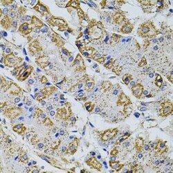 PRAMEF20 Antibody - BSA Free, Novus Biologicals 20 &mu;g | Buy Online | Novus Biologicals | Fisher Scientific