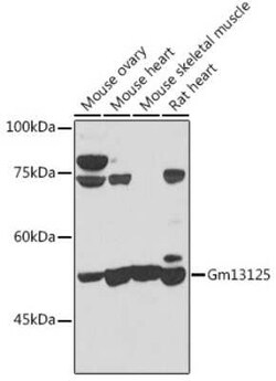 PRAMEF20 Antibody - BSA Free, Novus Biologicals:Antibodies:Primary Antibodies