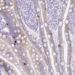 PRAP1 Antibody, Novus Biologicals:Antibodies:Primary Antibodies