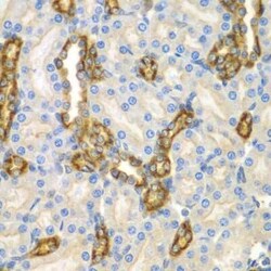 PRAT4A/TNRC5 Antibody - BSA Free, Novus Biologicals 0.02 mL; Unconjugated:Antibodies,