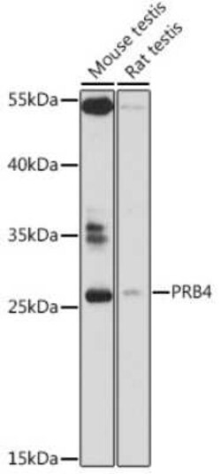 PRB4 Antibody - Azide and BSA Free, Novus Biologicals 100 &mu;g; Unconjugated:Antibodies,