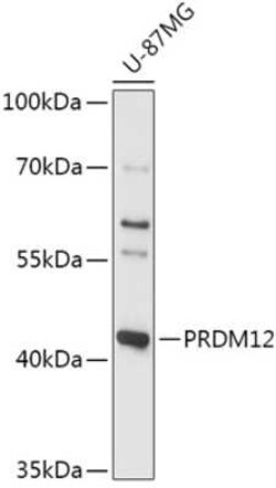 PRDM12 Antibody - Azide and BSA Free, Novus Biologicals 0.02 mL | Buy Online | Novus Biologicals | Fisher Scientific