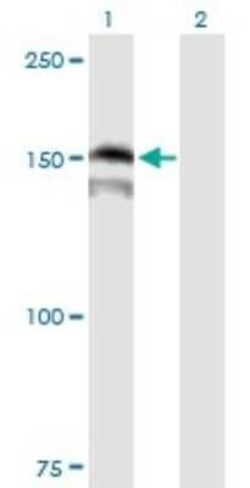 PRDM15 Antibody, Novus Biologicals 0.05 mg; Unconjugated:Antibodies, Polyclonal
