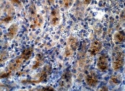 PRDM9 Antibody, Novus Biologicals 100 &mu;g; Unconjugated:Antibodies, Polyclonal
