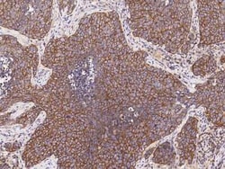 PRG-1/LPPR4 Antibody, Novus Biologicals:Antibodies:Primary Antibodies