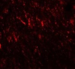 PRICKLE2 Antibody - BSA Free, Novus Biologicals 0.1 mg | Buy Online | Novus Biologicals | Fisher Scientific