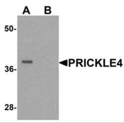 PRICKLE4 Antibody - BSA Free, Novus Biologicals 0.1 mg | Buy Online | Novus Biologicals | Fisher Scientific