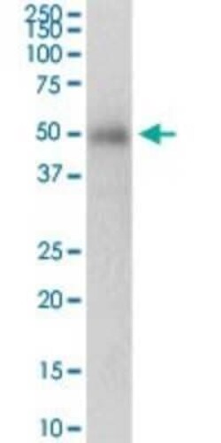 PRKAG2 Antibody, Novus Biologicals 0.1 mg | Buy Online | Novus Biologicals | Fisher Scientific