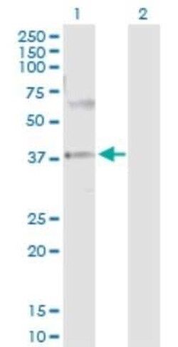 PRKAG2 Antibody, Novus Biologicals 0.1 mg | Buy Online | Novus Biologicals | Fisher Scientific