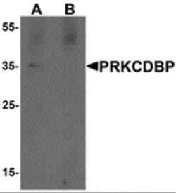 PRKCDBP Antibody - BSA Free, Novus Biologicals 0.1 mg; Unconjugated:Antibodies,