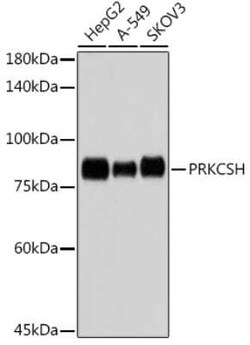 PRKCSH Rabbit anti-Human, Clone: 4Z3K3, Novus Biologicals 100 &mu;g; Unconjugated:Antibodies,