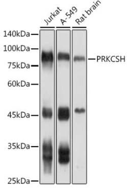 PRKCSH Rabbit anti-Human, Mouse, Rat, Polyclonal, Novus Biologicals 100