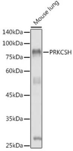PRKCSH Rabbit anti-Human, Mouse, Rat, Polyclonal, Novus Biologicals 100