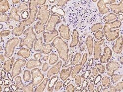 PRKD3/nPKC nu Antibody, Novus Biologicals 100 &mu;g, Unconjugated:Anticorps,