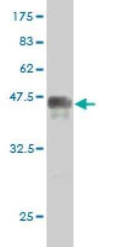 PRKRIP1 Antibody (3B11), Novus Biologicals 0.1 mg | Buy Online | Novus Biologicals | Fisher Scientific