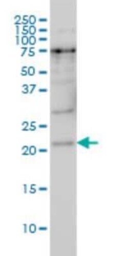PRKRIP1 Antibody (4D11-3F11), Novus Biologicals 0.1 mg | Buy Online | Novus Biologicals | Fisher Scientific