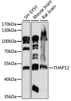 PRKRIR Antibody - Azide and BSA Free, Novus Biologicals 0.02 mL; Unconjugated:Antibodies,