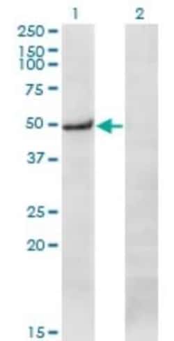 Novus Biologicals PRKX Antibody (1H7), Novus Biologicals 0.1 mg | Buy Online | Novus Biologicals&trade; | Fisher Scientific