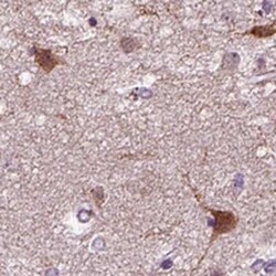 PRLH Antibody, Novus Biologicals 25 &mu;L | Buy Online | Novus Biologicals | Fisher Scientific