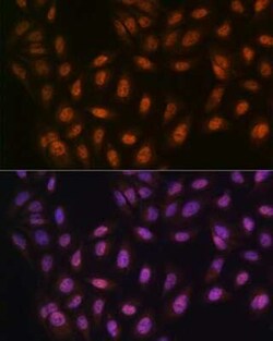 PRMT1 Rabbit anti-Human, Mouse, Rat, Clone: 10W10U4, Novus Biologicals