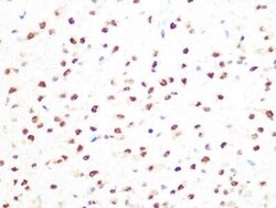 PRMT1 Rabbit anti-Human, Mouse, Rat, Clone: 10W10U4, Novus Biologicals