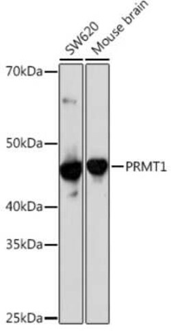 PRMT1 Rabbit anti-Human, Mouse, Rat, Clone: 10W10U4, Novus Biologicals