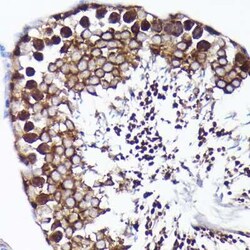 PRMT5 Rabbit anti-Human, Mouse, Rat, Clone: 7K2G5, Novus Biologicals 100
