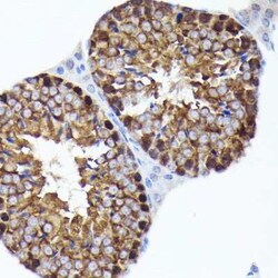 PRMT5 Rabbit anti-Human, Mouse, Rat, Clone: 7K2G5, Novus Biologicals 100