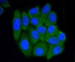 PRMT5 Rabbit anti-Human, Clone: ST51-06, Novus Biologicals 100&mu;L:Antibodies,