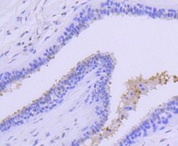 PRMT5 Rabbit anti-Human, Clone: ST51-06, Novus Biologicals 100&mu;L:Antibodies,