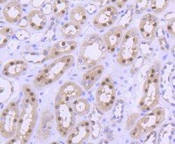 PRMT5 Rabbit anti-Human, Clone: ST51-06, Novus Biologicals 100&mu;L:Antibodies,